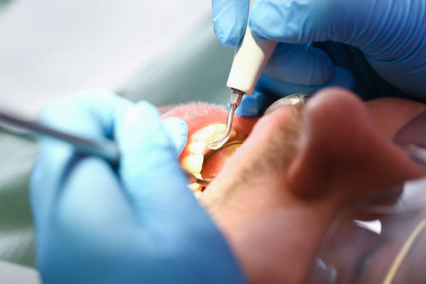 Best Broken or Chipped Tooth Repair in Hildebran, NC